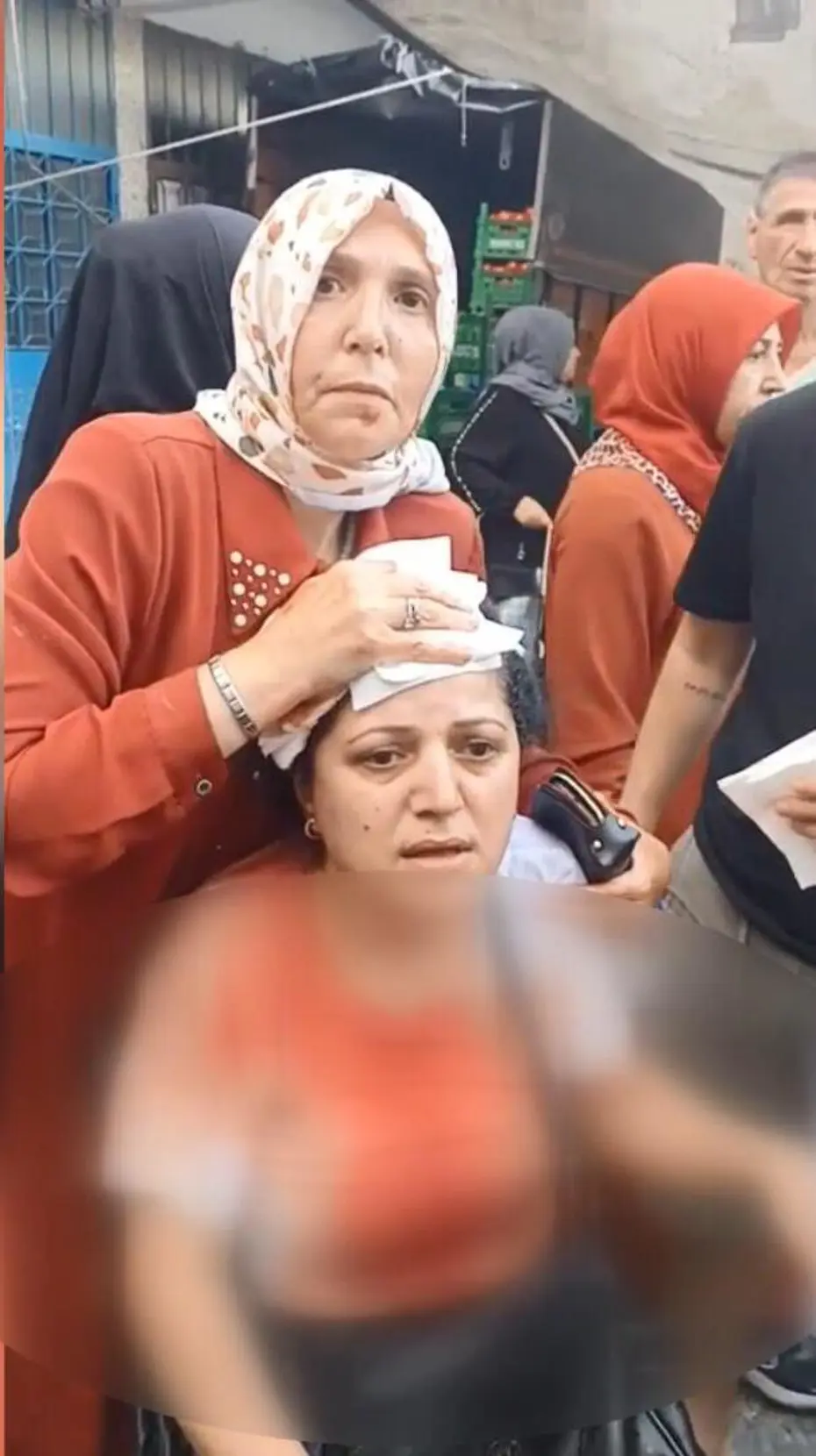 Beyoğlu'nda Semt Pazarında Dehşet: Armut Seçme Tartışmasında Kadının Başına 10 Dikiş Atıldı