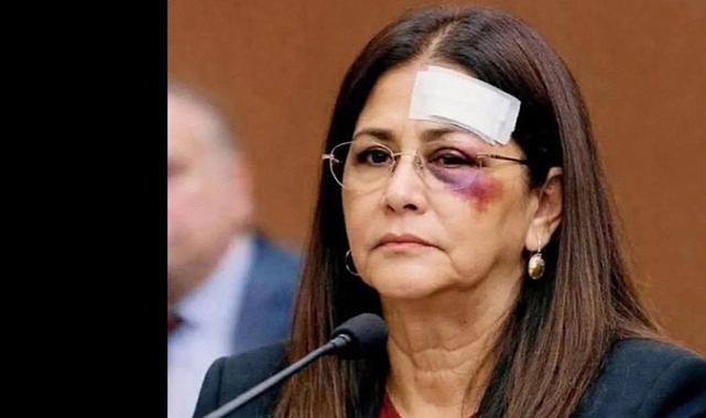 Cilia Flores ABD Mahkemesinde Yaralı Olarak Görüldü: Trump'a Sert Tepki