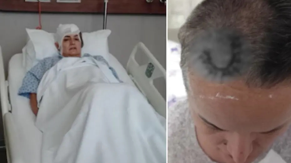 Diş Tedavisi Kabusu: Beyninde Cihazla Yaşamak Zorunda Kaldı