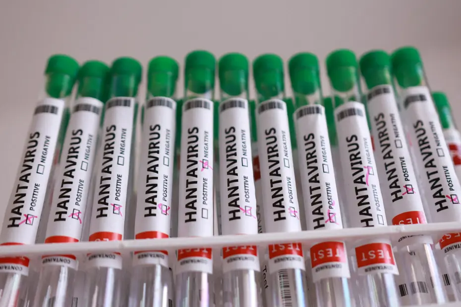 Hantavirüs Alarmı: Fransa ve ABD'den Kritik Sağlık Durumu Açıklaması