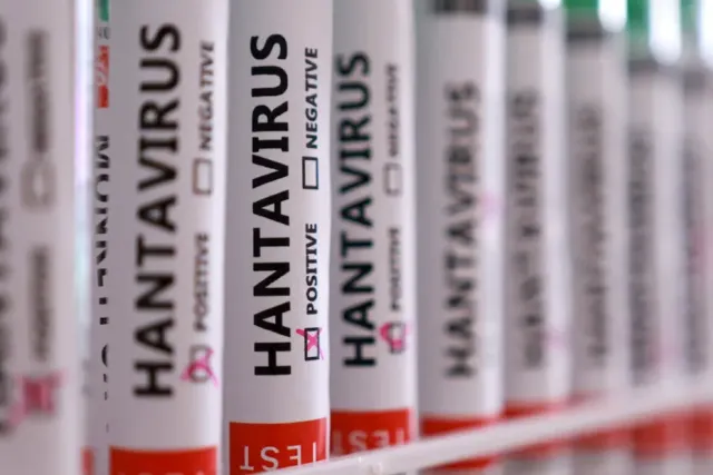 Hantavirüs Endişesinde Sevindiren Haber: Hollandalı Görevlinin Testi Negatif