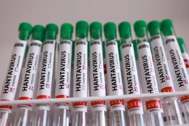 Hantavirüs Alarmı: Fransa ve ABD'den Kritik Sağlık Durumu Açıklaması