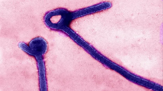 Ebola Kabusu Geri Döndü: Nadir Tür Hızla Yayılıyor, DSÖ Acil Durum Alarmında