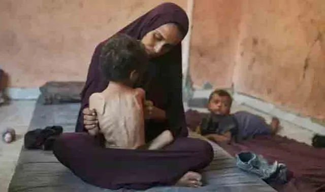 Gazze’de Derinleşen Açlık Krizi: Her Beş Çocuktan Biri Yaşamını Yitiriyor