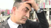 Genç görünme hayali kabusa dönüştü: 4 kez bıçak altına yattı