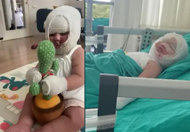 Mersin'de Korkunç Olay: Patlayan Domates Konservesi 9 Aylık Bebeği Yaktı