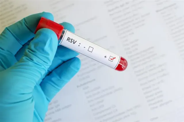 RSV Virüsü Uyarısı: Çocuklar İçin Hayati Tehlike Oluşturuyor