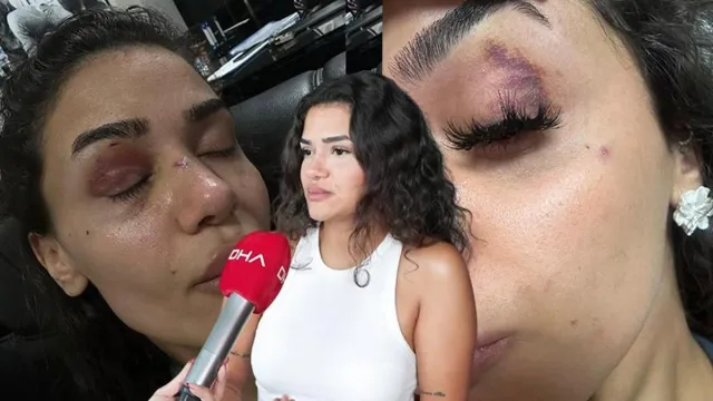 Ebru Hemşireden Hayati Tehlike Çığlığı: Ölmeden Önce Sesimi Duyun